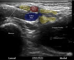 Image result for Axillary Nerve Block
