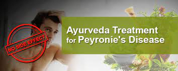 Ayurveda Treatment For Peyronies Disease Khokar