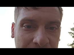 Cade Crawford Be The Match Interview