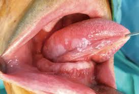 The grade describes the appearance of the cancerous cells. Elective Neck Dissection In Early Oral Squamous Cell Carcinoma Necessary