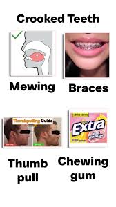 How to Straighten Teeth Naturally at Home