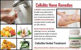 6 Effective Cellulitis Home Remedies Natural Herbal Remedies Herbal Remedies Herbal Treatment