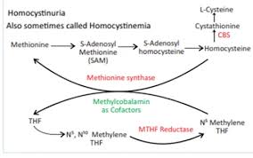 Image result for Homocystinuria