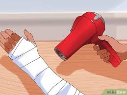 Cycle of skin splitting, peeling, then thick brownish cast skin over.recycles. How To Scratch Under Your Cast 12 Steps With Pictures Wikihow