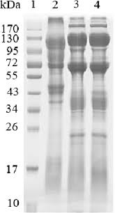 The extracted venom of each spider was. Physiological And Biochemical Characterization Of Egg Extract Of Black Widow Spiders To Uncover Molecular Basis Of Egg Toxicity