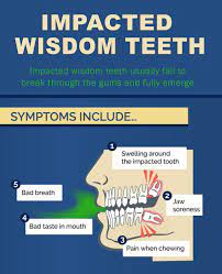 Pin On Oral Surgery