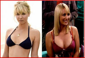 Résultat de recherche d'images pour "breast implant before and after"