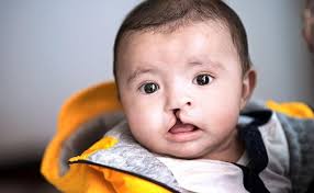 Exploring Temporally-Variable Surgical Catchment Areas.