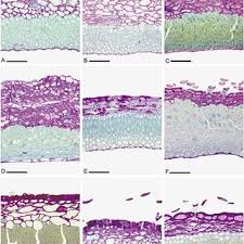 Image result for Pearsonia mesopontica