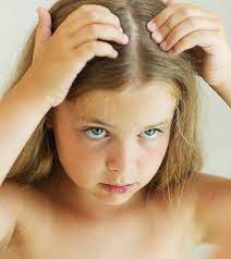 Some of the common causes for hair loss in children includes tinea capitis, alopecia areata, trichotiillomania, nutritional deficiency,hypothyroidism, constant rubbing, hair abuse, to name a few. What Are The Main Causes Of Hair Loss In Children Sudden Hair Loss Hair Loss In Children Vitamins For Hair Loss