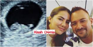 Aplikasi ini adalah percuma dan dikhaskan kepada semua pengguna android kami telah custom design kesemua kad ucapan tahniah ini dan semoga anda semua akan berkongsi bersama dengan rakan rakan anda melalui. Doakan Semoga Baby Sihat Sempurna Jadi Manusia Berguna Sharnaaz Tak Percaya Bakal Jadi Bapa Kisah Dunia