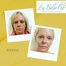 This salon offers a customizable . La Belle Vie Medical Care And Aesthetics Home Facebook