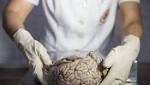  Ethics debate overdue in human brain research: experts