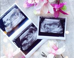 The Black Pearl Blog Uk Beauty Fashion And Lifestyle Blog Pregnancy Update 13 15 Weeks