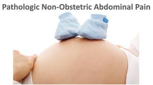 Emdocs Net Emergency Medicine Educationemergency Department Evaluation And Management Of Non Obstetric Pathologic Abdominal Pain In The Pregnant Patient Emdocs Net Emergency Medicine Education