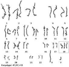 Human Chromosomal Disorders