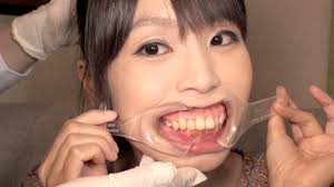 開口器と鼻フックで制圧された女子の画像53枚！ | 俺のヌキネタ