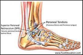 The equine foot has a pair of cruciate distal sesamoidean ligaments in the metacarpophalangeal joint. Chronic Peroneal Tendon Subluxation Footeducation