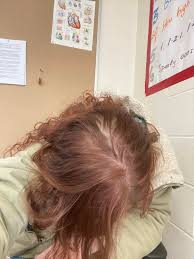 In particular, short haircuts tend to suit thin hair best. Naturally Thin Hair But This May Be More Please Help More Info In Comments Femalehairloss