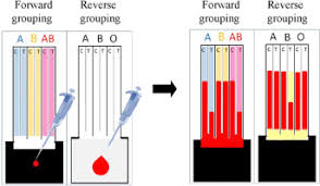 Simultaneous Forward And Reverse Abo Blood Group Typing