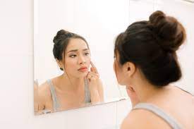 Check spelling or type a new query. 10 Masker Alami Untuk Menghilangkan Jerawat Halaman All Kompas Com