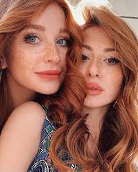 So charming freckles