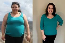 Janna Got Her Life Back With Weight Loss Surgery Custom Content More The Chronicle Herald