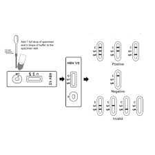 Image result for Herpes Simplex Virus Testing