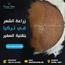 sapphire hair transplant in turkey hair transplant transplant hair