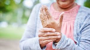 CID m255 aposenta: como funciona a comprovação da doença?