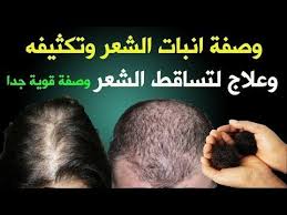 علاج تساقط الشعر وانباته من جديد وتنعيمه ولمعانه والتخلص من القشرة والقضاء على الثعلبة Youtube Medical Movie Posters