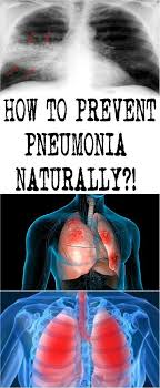 How To Prevent Pneumonia Naturally All What You Need Is Here Prevention Pneumonia Health Disease