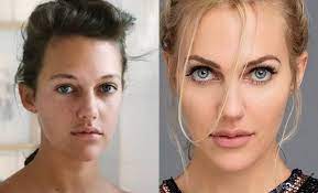 Check spelling or type a new query. Meryem Uzerli Den Sasirtan Estetik Aciklamasi