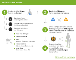 Aktuelle infos zur behandlung, ernährung und studien. Gicht Ursachen Symptome Diagnose Behandlung