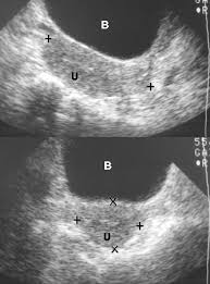 Check spelling or type a new query. Radiology In Ped Emerg Med Vol 4 Case 8