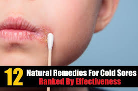 12 Home Remedies For Cold Sores Ranked By Effectiveness Cold Home Remedies Cold Sores Remedies Cold Sore