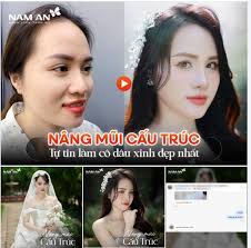 NÂNG MŨI CẤU TRÚC PHONG THỦY KHÁC GÌ VỚI NÂNG MŨI THÔNG THƯỜNG