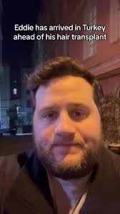 Tirkish Hair Plugs Barstool