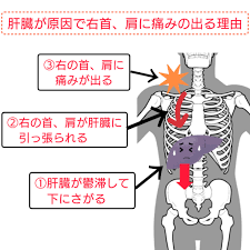 右 肩 が 痛い 肝臓