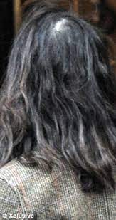 It can begin earlier for some women. Female Hair Loss When Thea Jourdan Hit 40 Her Glorious Chestnut Mane Began To Fall Out Daily Mail Online