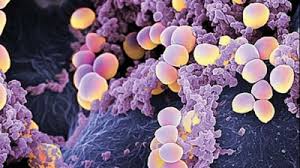 Ce este acest virus, care sunt cauzele aparitiei lui, dar si recomandari de tratamente naturiste. Ai Aceste Simptome Mare AtenÅ£ie E Stafilococ Auriu