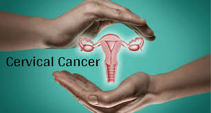 A recent report that 93 per cent of invasive cervical cancers worldwide contain human papillomavirus (hpv) may be an underestimate the presence of hpv in virtually all cervical cancers implies the highest worldwide attributable fraction so far reported for a specific cause of any major human cancer. Cervical Cancer Symptoms Causes Stages And Risk Factors