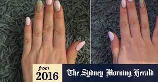 Maybe you tried to put on a pair of gloves that were too small and once you took them off, you couldn't straighten your finger all the way. Is Smartphone Pinky Real Probably Not But Phones Can Still Cause Damage