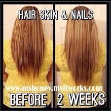 Natural Hair Biotin Before And After This Is A Before And After Of 2 Week Results On The Hair Skin Nail Pills The Pills Have Natura Hair Skin Nails Hair Skin Nails Supplement Longer Stronger Hair