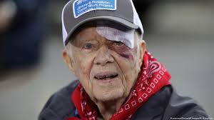 Jimmy carter, полное имя джеймс эрл ка́ртер — мла́дший, англ. Former Us President Jimmy Carter Admitted To Hospital For Brain Procedure News Dw 12 11 2019