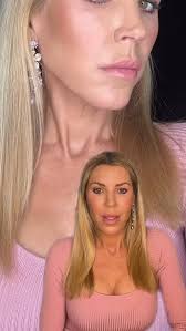 Thank you for all of your questions about skin tacking. I will do my best  to answer all of them in this video. This treatment is a novel treatment  exclusive to Armstrong, MD. Through the use of Skin ...