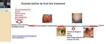 Acum imi organizez singur activitatea avand un cabinet de consultatii gastroenterologie si hepatologie in clinica sante bucuresti. Virusul Hepatitei Clinica Gastroenterologie Sector 2 Bucuresti