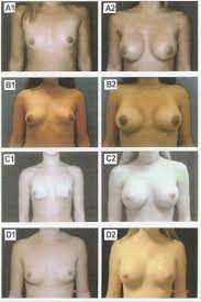 Nude Breast Size Chart