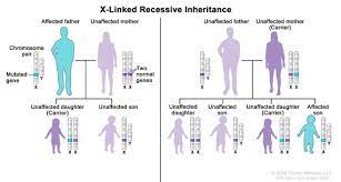 Carrier females can manifest mild forms of the trait due to the inactivation of the dominant allele located on one of the x chromosomes. Definition Of X Linked Recessive Inheritance Nci Dictionary Of Genetics Terms National Cancer Institute