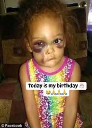 Because of my condition no one will wish me happy birthday 🎉😭